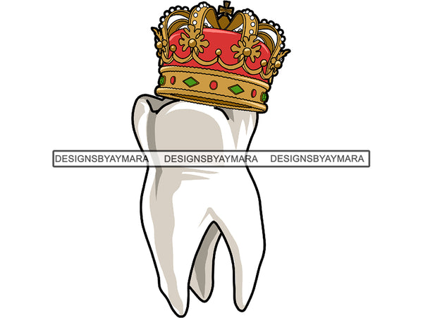 Golden Gold Crown On A Tooth JPG PNG Clipart Cricut Silhouette Cut Cutting